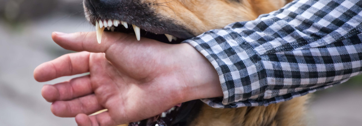 dog biting a person's hand